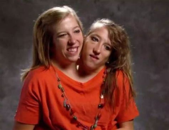Abby and Brittany Dead: Exploring the Truth Behind the Headlines