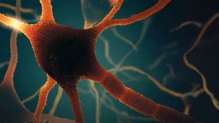 Carly Imon Parkinson's Disease: A Comprehensive Overview
