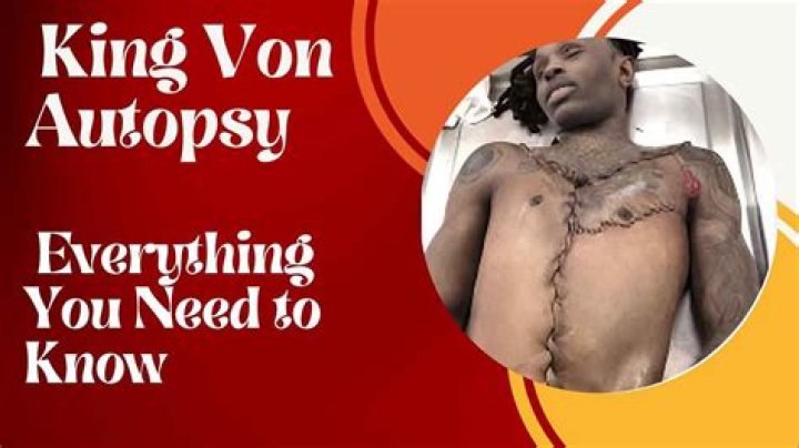 King Von Autopsy Photos: Outrage and Controversy Explained