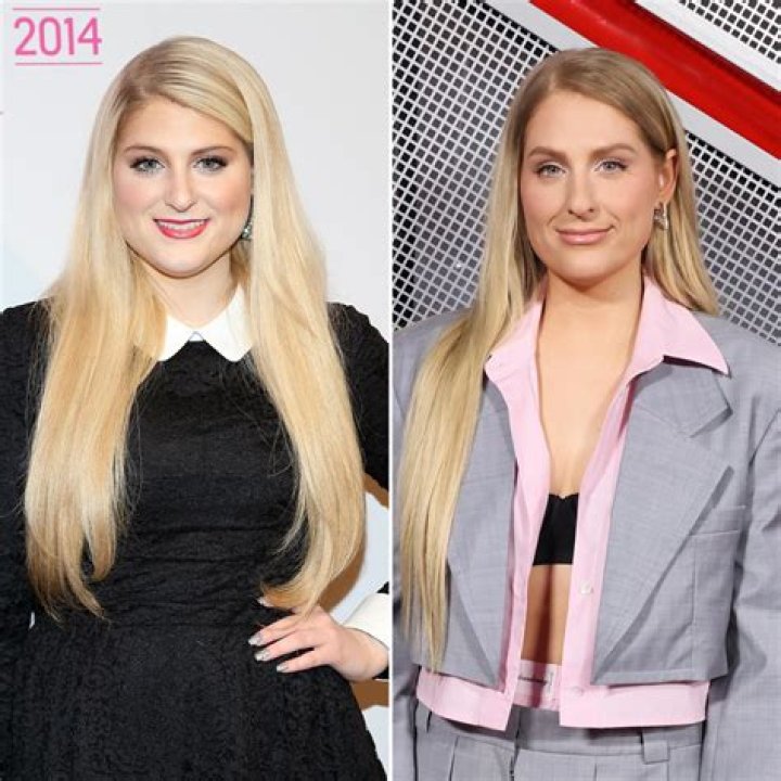 Meghan Trainor: Transformation, Surgery & More - Latest News