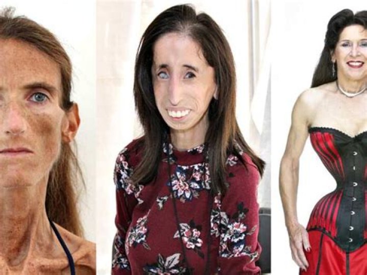 The Identity of the Skinniest Person in the World: A Comprehensive Exploration